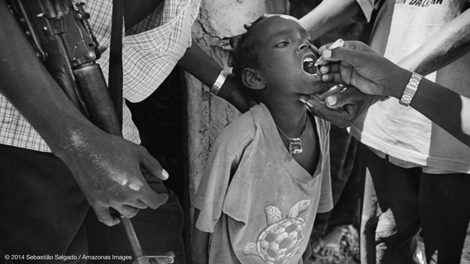 "Scenes From the Polio Fight" 